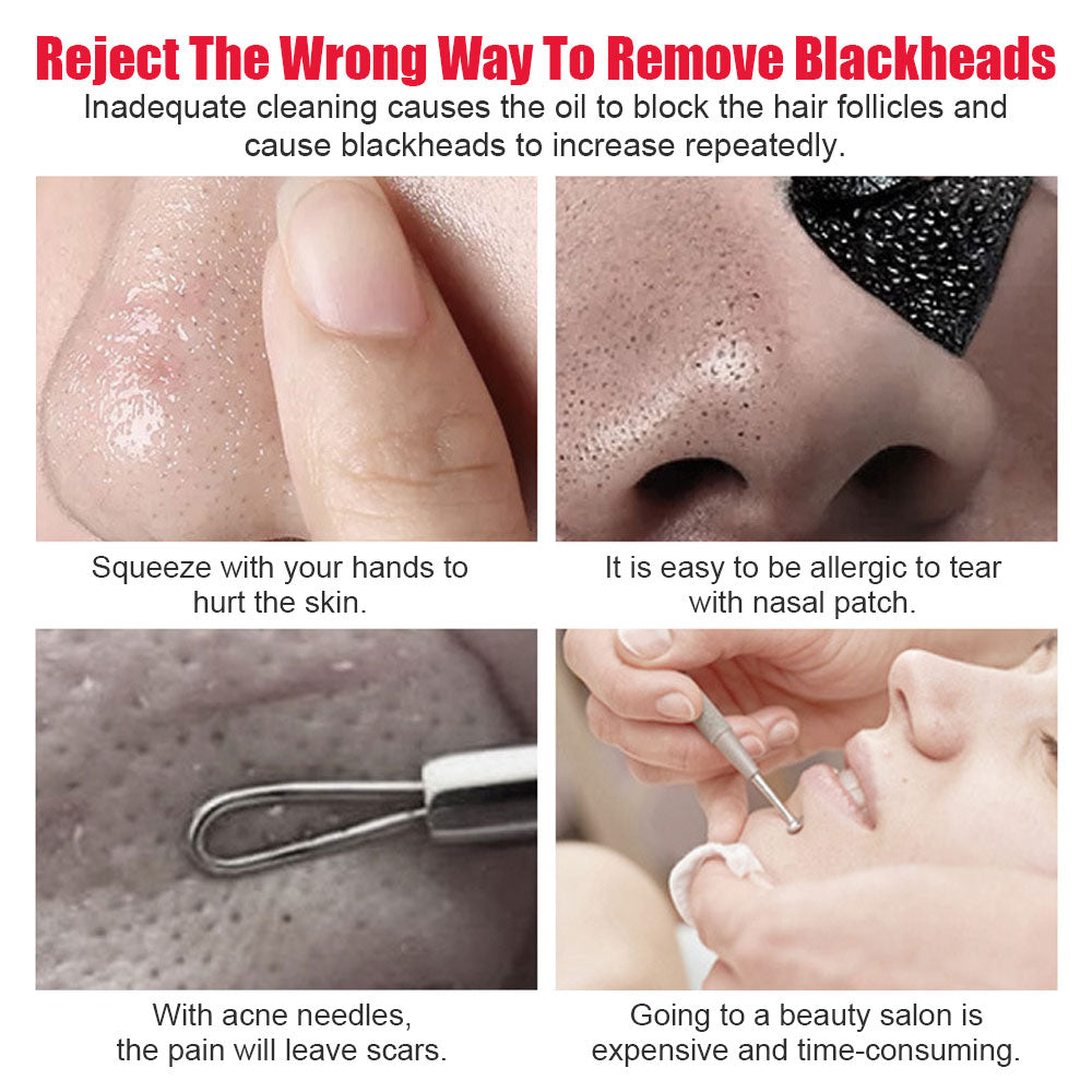 Remover Pore Acne Pimple Removal Face Nose Cleaner